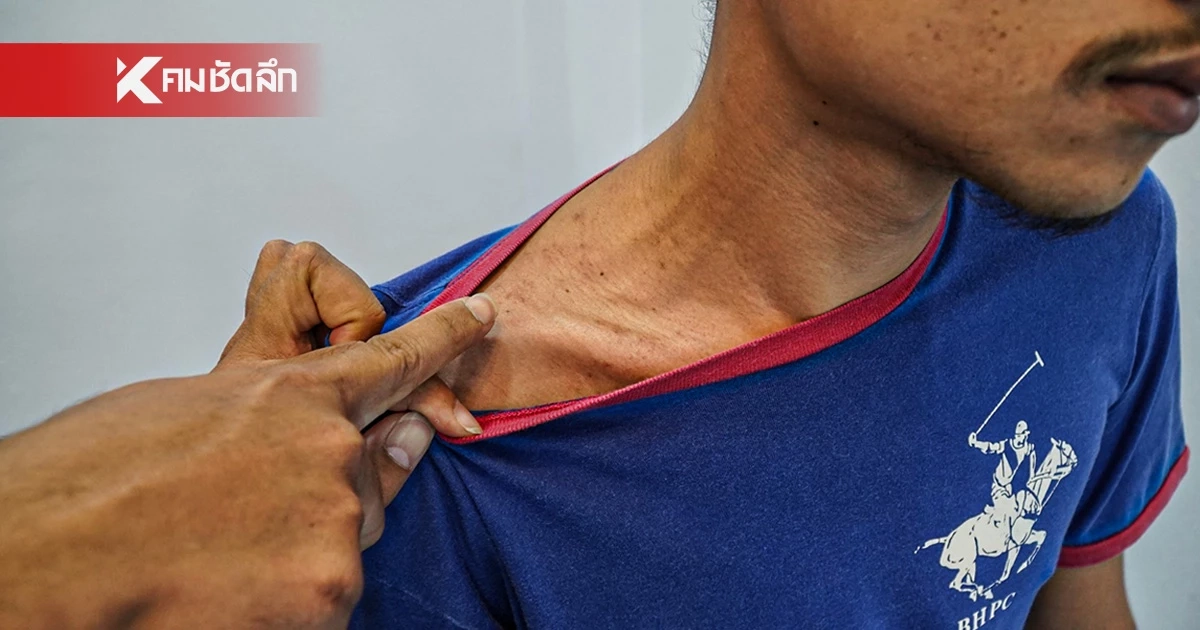 หนุ่มแจ้งความ "สิบตำรวจตรี" บุกทำร้ายถึงในบ้าน