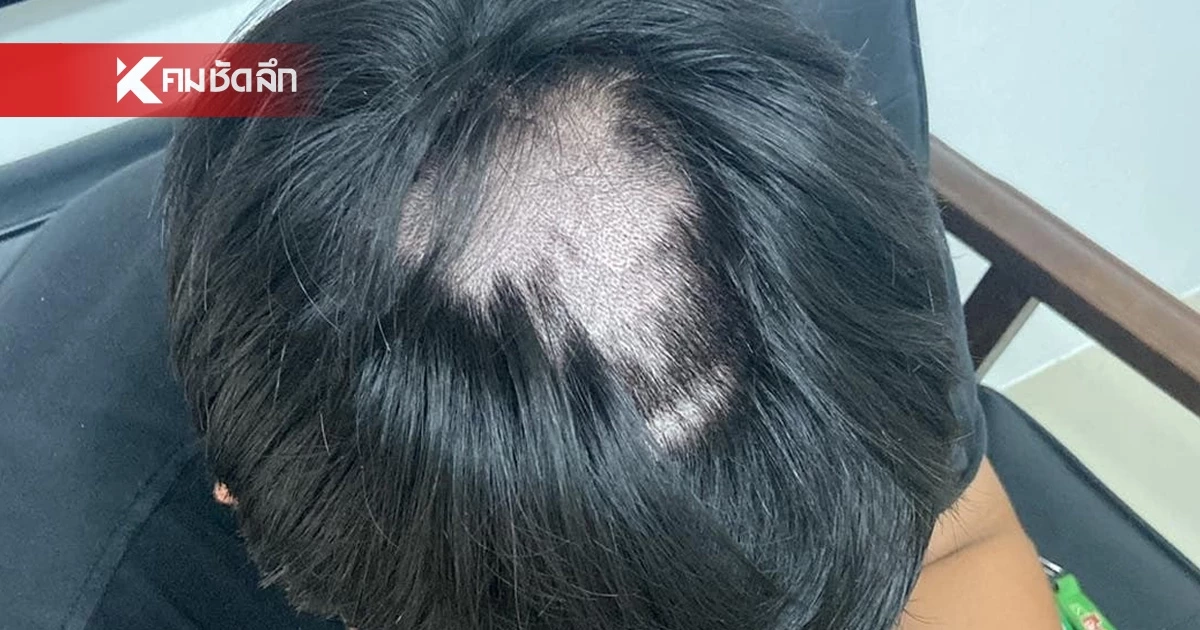 พรรคประชาชน ลงพื้นที่ ครูกล้อนผม นศ. ล่าสุดสถาบันเลิกจ้างแล้ว พรรคประชาชน ลงพื้นที่ ครูกล้อนผม นศ. ล่าสุดสถาบันเลิกจ้างแล้ว