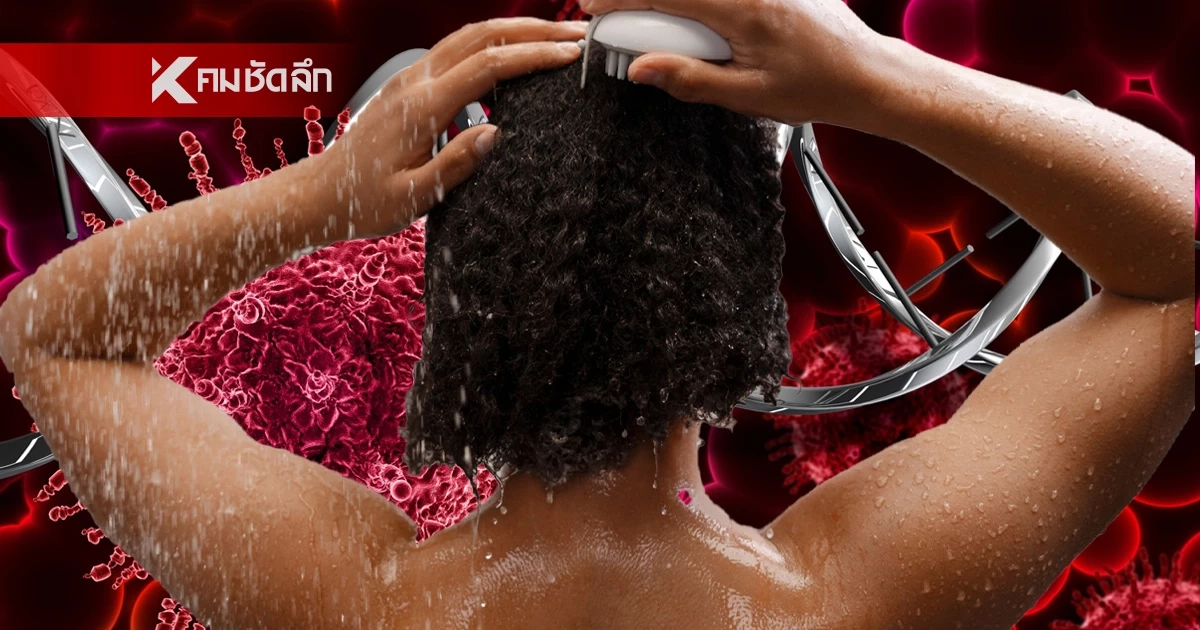 สาววัย 40 ปี ป่วยมะเร็งผิวหนัง แพทย์เฉลยต้นตอมาจากนิสัยการอาบน้ำ?