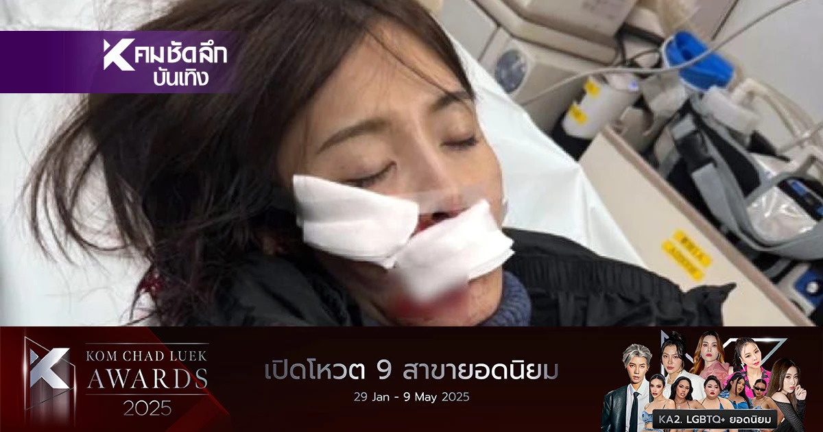 ช็อก! ”นางเอกหนังดัง“ประสบอุบัติเหตุ? ก่อนเงียบหายนาน ไม่กล้าโพสต์โซเชียล ช็อก! ”นางเอกหนังดัง“ประสบอุบัติเหตุ? ก่อนเงียบหายนาน ไม่กล้าโพสต์โซเชียล