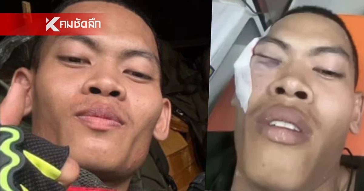 เปิดใจ พลทหารตะวัน ในวันที่สูญเสียตา 1 ข้าง หลังถูกสะเก็ดระเบิด