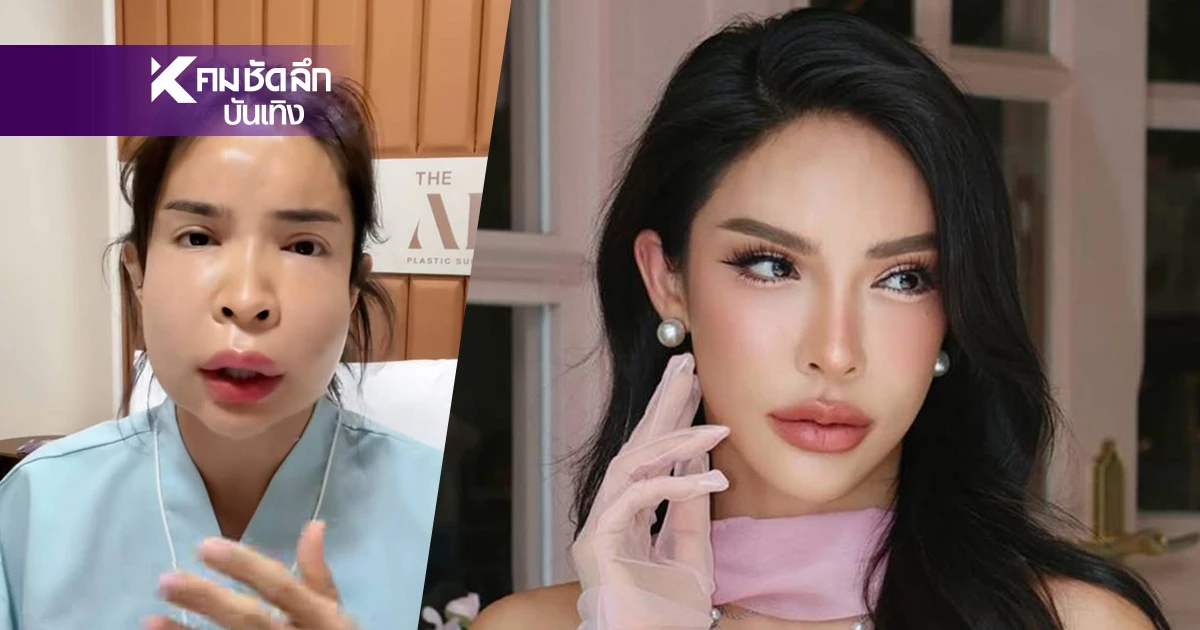 อินฟลูชื่อดัง เกือบขิตเพราะ "หมอกระเป๋า" ดูดหนองออกข้างละ 30 cc