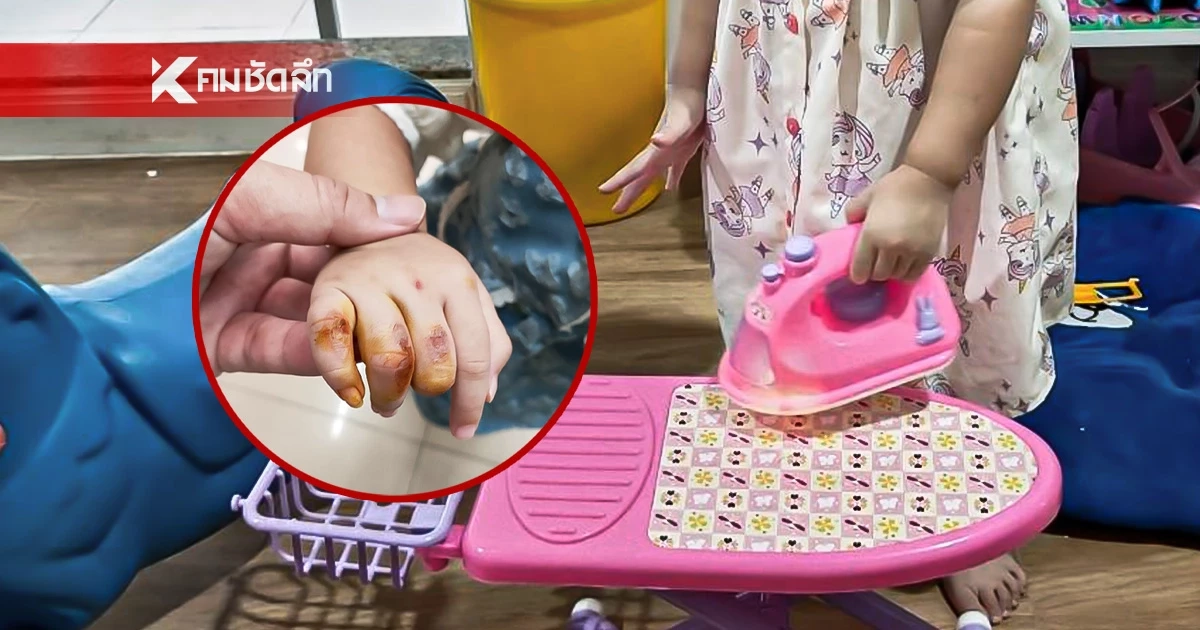 แม่โพสต์เตือน ลูกเล่น "เตารีดของเล่น" แต่ดันอยากจับของจริง ทำเกือบนิ้วขาด