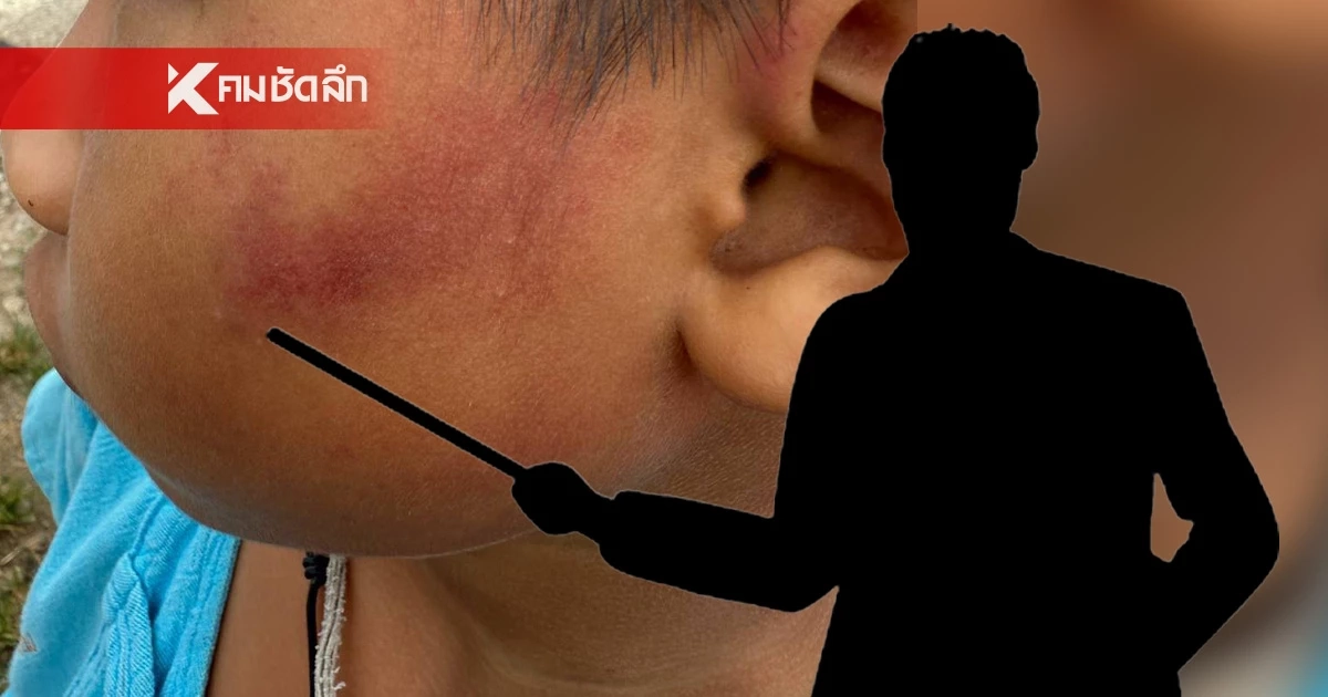 ครูใจอํามหิต! ใช้ฟุตเหล็กฟาดหน้าเด็ก ป.1  ปม! หยิบขนมบนโต๊ะครูกิน