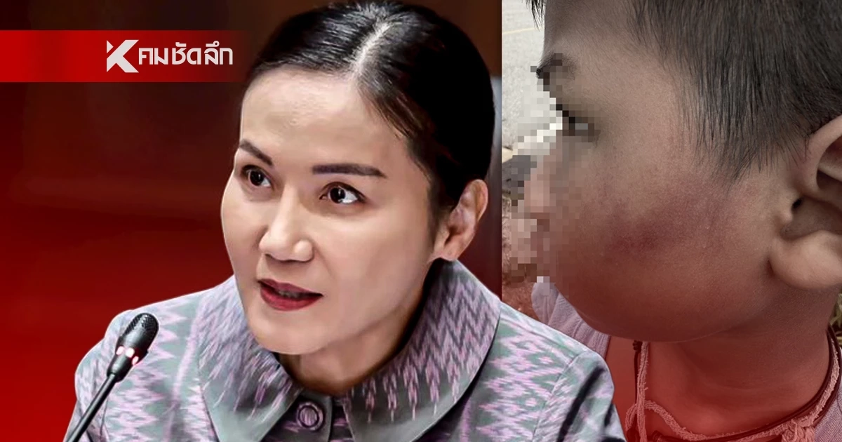 "รมว.นฤมล" เดือด! สั่งคุรุสภาลงดาบ "ครู" ใช้ฟุตเหล็กตีเด็ก ป.1