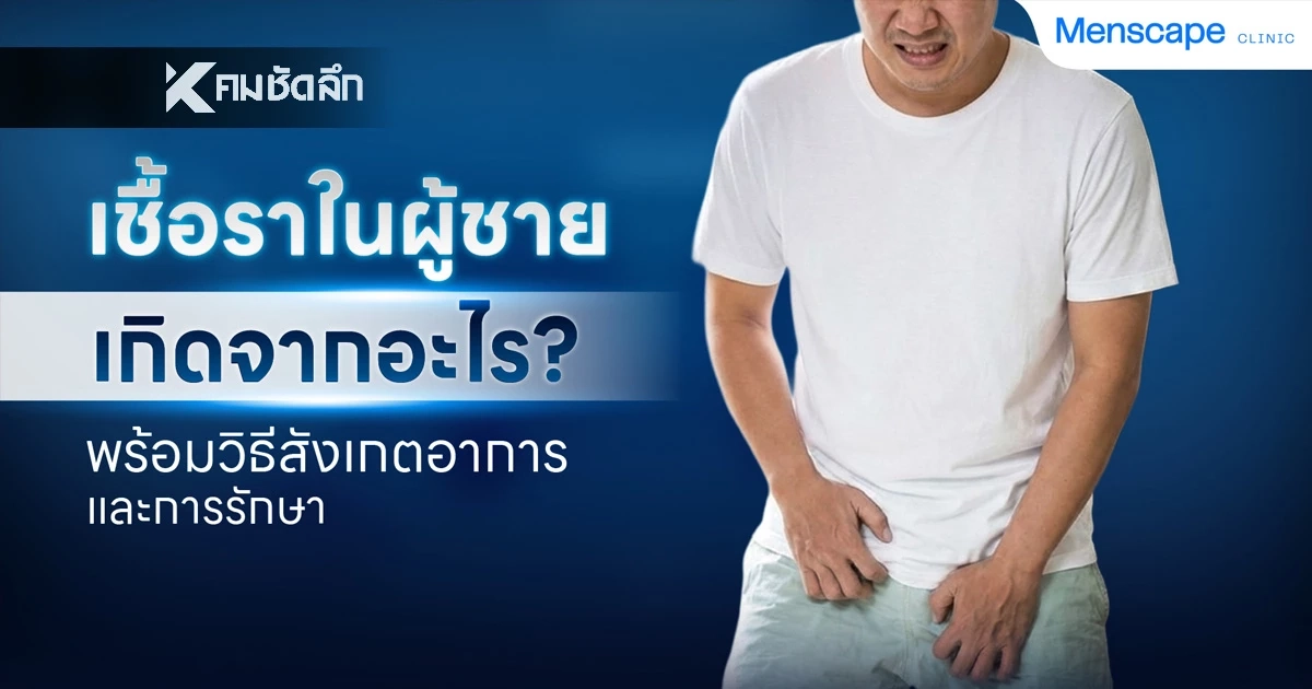 เชื้อราในผู้ชาย เกิดจากอะไร? พร้อมวิธีสังเกตอาการและการรักษา