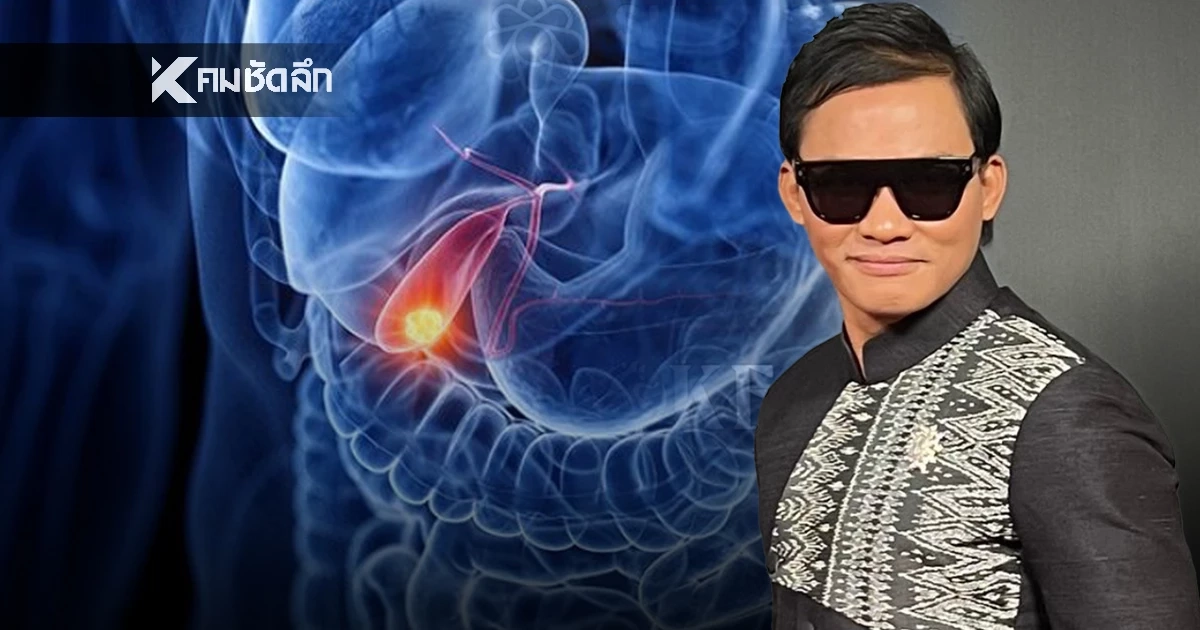 รู้จักโรคร้าย "มะเร็งถุงน้ำดี" หลังยอดนักบู๊ "จา พนม" ป่วยระยะลุกลาม