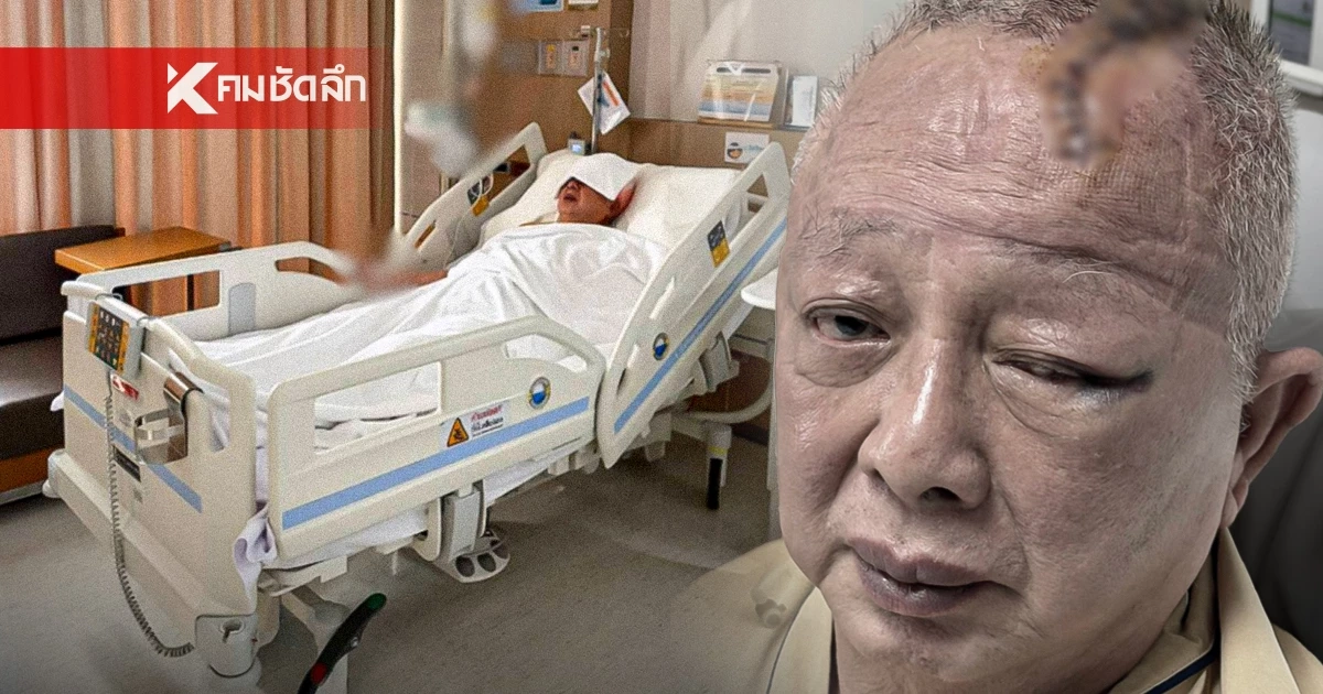 อัปเดตอาการ "สนธิ" ล้มหัวฟาดเสาเย็บ 20 เข็ม เผยลางสังหรณ์เหมือนมีคนผลัก