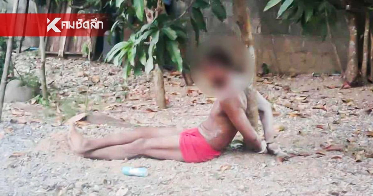 ผู้ว่าฯ พัทลุง สั่งสอบ "กำนันโหด" ทำร้ายลูกบ้าน ให้มดแดงรุมกัด