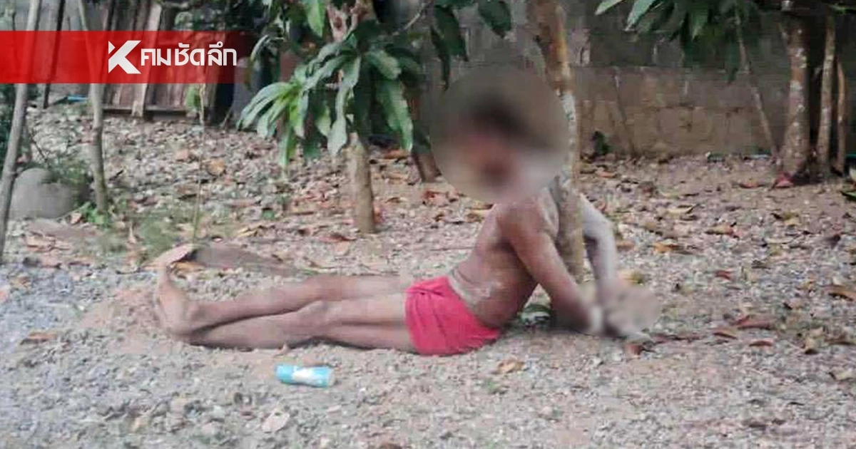 แจ้งจับ! กำนันโหด จับหนุ่มมัดไพล่หลัง เขย่ารังมดแดงใส่หัว อ้างขโมยด้วง