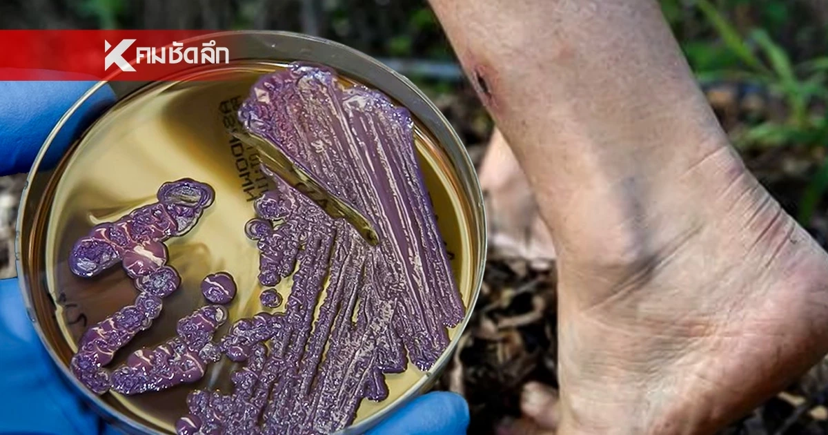  รู้จัก "โรคไข้ดิน" ภัยเงียบคร่าชีวิต  "มหิดล" แนะนวัตกรรมใหม่ตรวจเจอใน 15 นาที