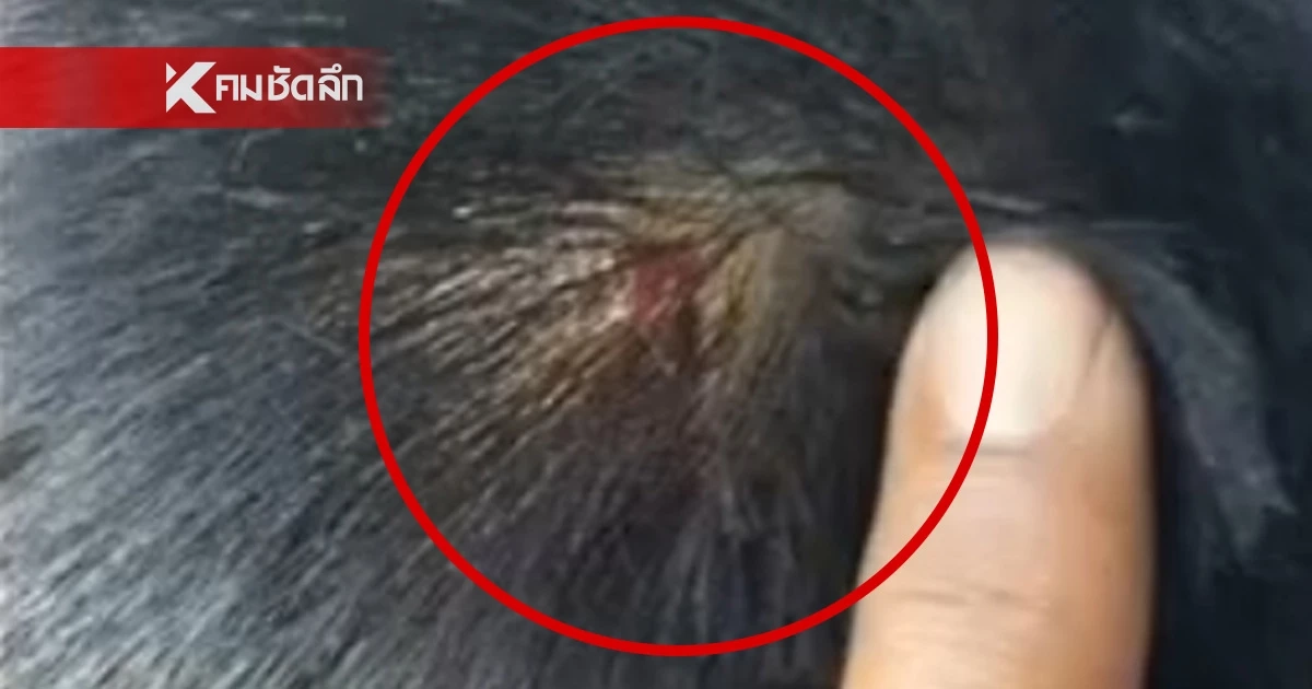 เกินไปไหม! ครูสอนพิเศษ เอามือถือฟาดเด็ก 7 ขวบหัวแตก ขอจ่าย 500 จบเรื่อง