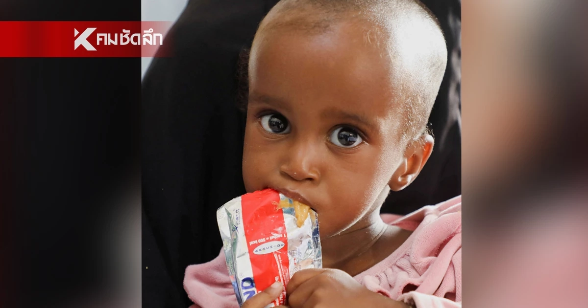 เด็กโซมาเลีย นับแสนคน ใกล้อดxาย เซ่นพิษวิกฤตช่องแคบฮอร์มุซ