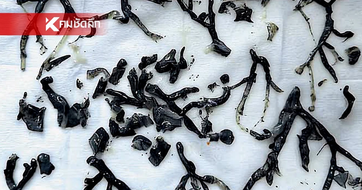 พื้นที่เผาป่า อันตราย! "เขม่าควันไฟ-ฝุ่น" อัดเป็นก้านสีดำ เสี่ยงหายใจล้มเหลว