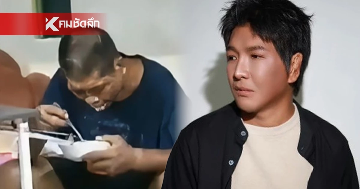 จำแทบไม่ได้ "น้องฟ้า" เหยื่อนายจ้างทารุณ จนใบหน้าผิดรูป ล่าสุดเหมือนเกิดใหม่