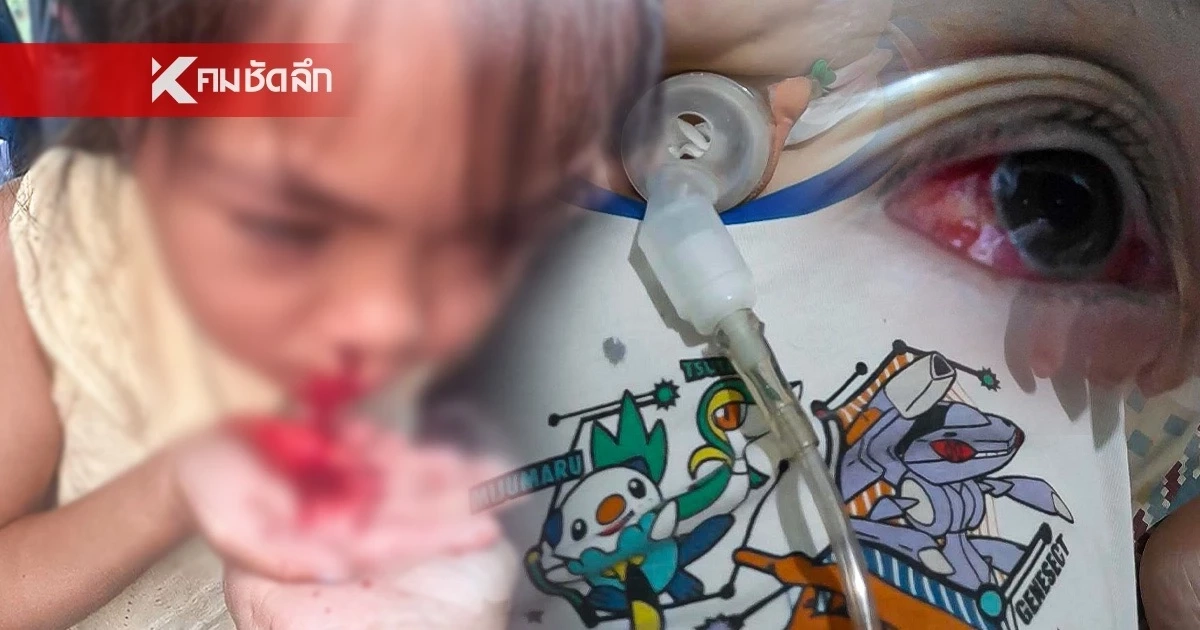 ค่าฝุ่น PM เชียงใหม่ ทำพิษ! คนxายผ่อนส่งมากขึ้น โดยเฉพาะเด็กๆ