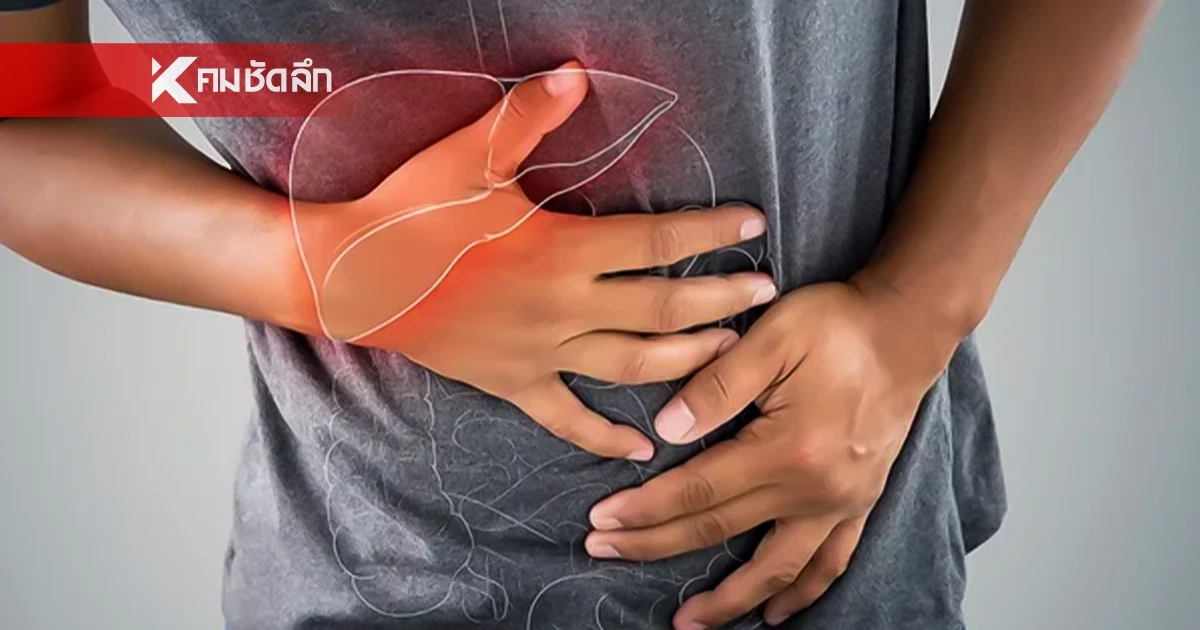 หน้าร้อนต้องระวัง “ตับอักเสบเอ” อาละวาด สถิติพุ่งสูงกว่าปีก่อนเท่าตัว