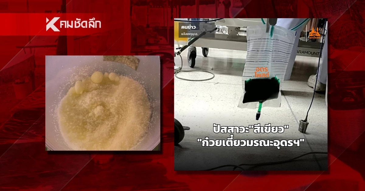 เหยื่อ ก๋วยเตี๋ยวมรณะอุดรฯ ขับพิษออกมาเป็น 'ปัสสาวะสีเขียว' หลังได้รับยาต้านฯ