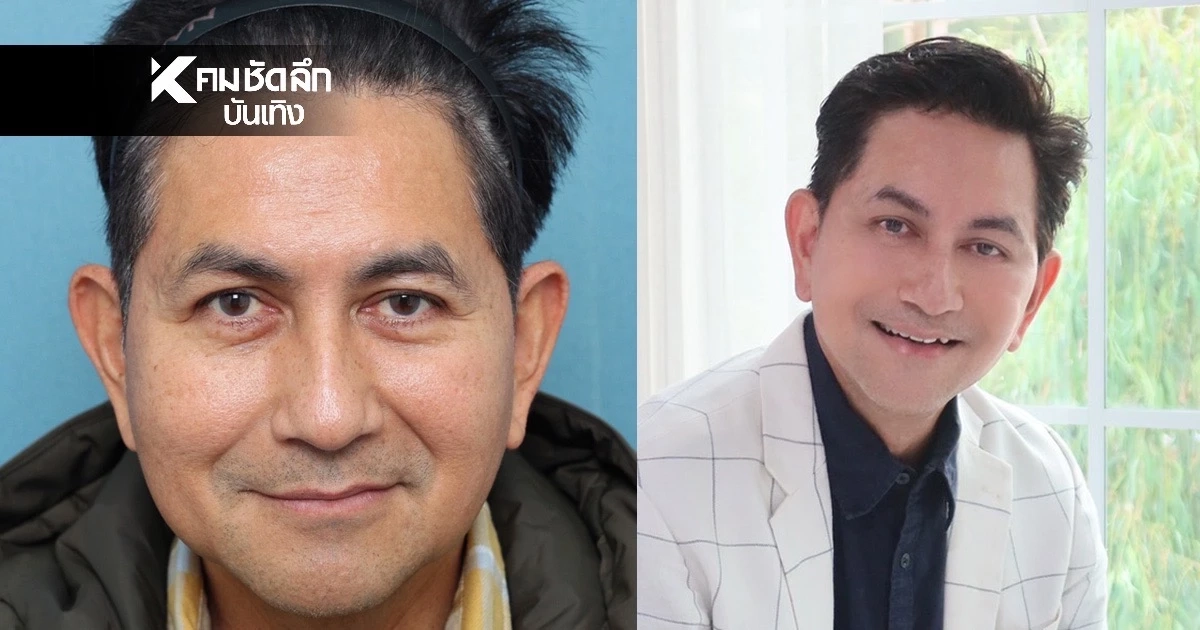 เปิดภาพ "ดุ๊ก ภาณุเดช" ศัลยกรรมยกหน้า ในวัย 59 ปี ทำเอาหลายคนอึ้ง!