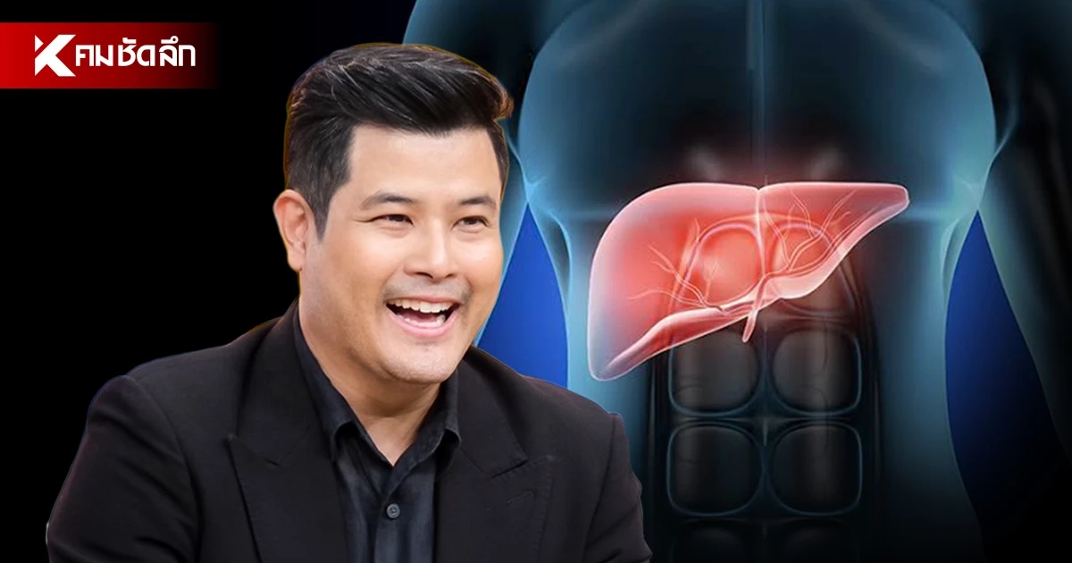 ถอดบทเรียน “เติ้ล ตะวัน” ไขมันพอกตับระยะรุนแรง ภัยเงียบไม่ดื่มก็เป็นได้!