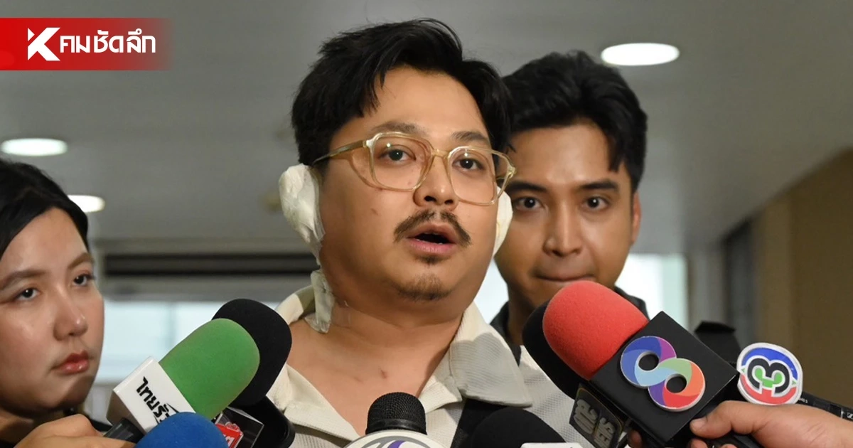 หัวหน้าวงทศกัณฐ์ เผย "ดิน" นักร้องนำ ถูกไฟคลอก 80% อาการยังทรงตัว