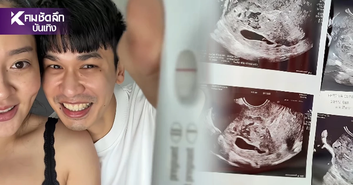 ส่งกำลังใจ "แก้มบุ๋ม" สูญเสียลูกในครรภ์ หลังพยายามมีลูกมาตลอด